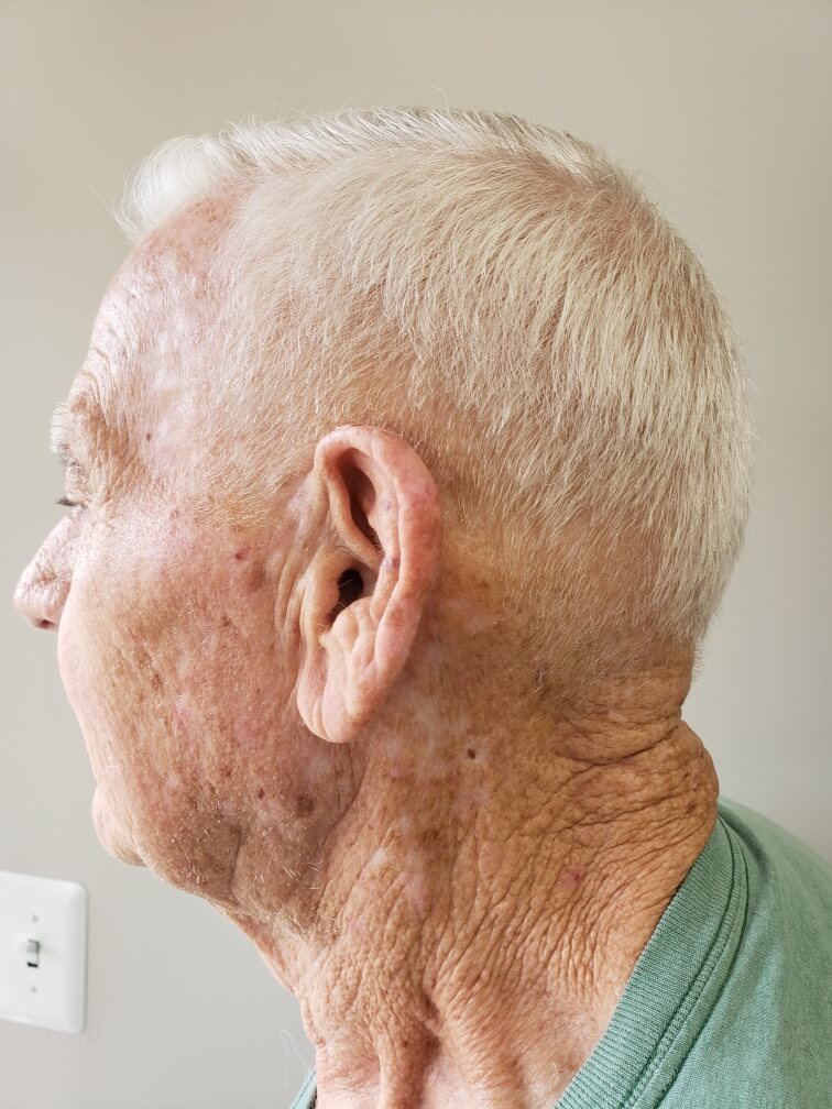 A short back and sides on white hair, cleanly tapered.